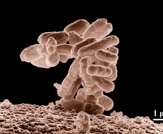 Drojdia si E. coli se pot dezvolta in conditii care ar putea exista pe planetele extraterestre