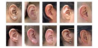 Tipuri de otoplastie: descopera tehnicile de chirurgie a urechii