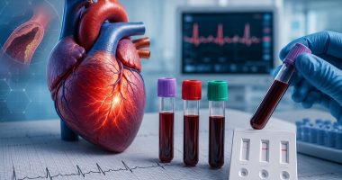 biomarkerii cardiaci
